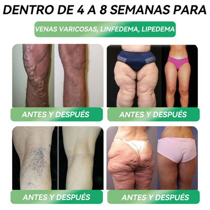 (HHVB®) ❤️ ¡Solo quedan 6 cajas! ¡Obtén un 30% de descuento hoy! La solución oral GLP-1 ayuda a controlar el peso y el azúcar en la sangre, con resultados duraderos en 4–6 cajas. ¡No esperes, actúa rápido!